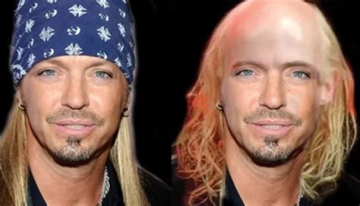 Bret Michaels Bald And Why Does He Always