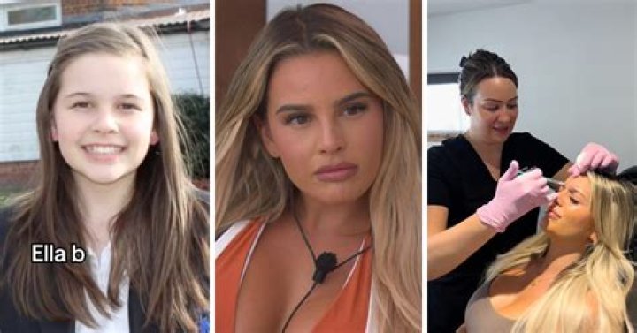 Ella B Love Island Before Surgery, Body Tranformation And Instagram