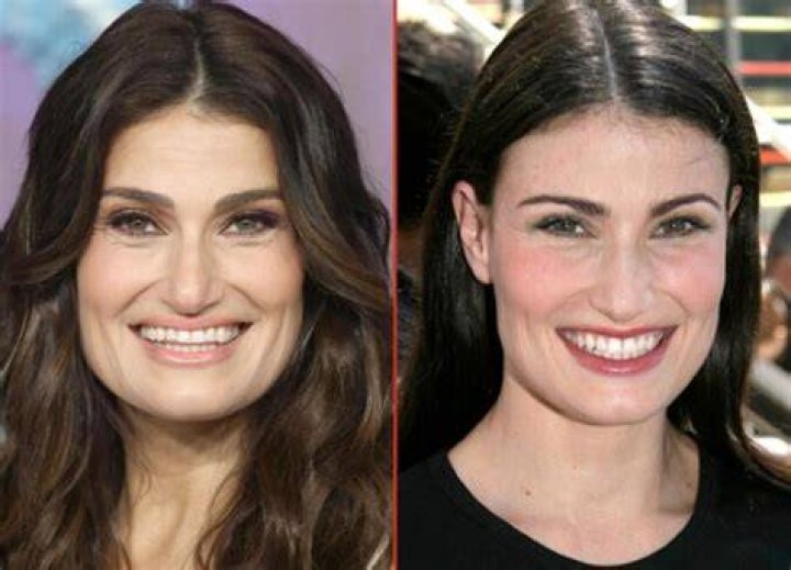Idina Menzel Nose Job | Before And After Photos