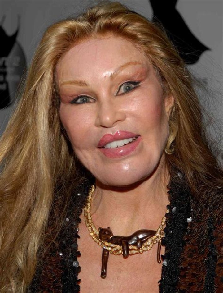 Jocelyn Wildenstein