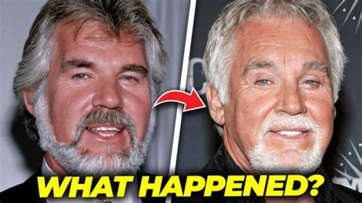 Kenny Rogers | Did He Have Dementia? What Caused His Death