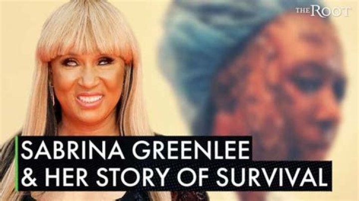 Sabrina Greenlee | Before and After Acid Attack: Hopkins Mother