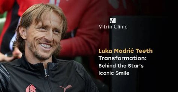 What Is Wrong With Luka Modric Teeth? Croatian Captain Meme Explained